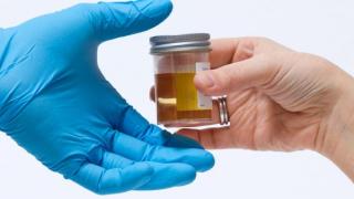 Delapan Karyawan Perusahaan Sawit Terjaring Saat Tes Urine 